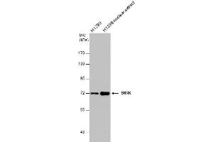 Image no. 4 for anti-SNF Related Kinase (SNRK) (Internal Region) antibody (ABIN2856805)