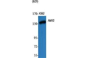 Image no. 2 for anti-Abelson Murine Leukemia Viral Oncogene Homolog 1/2 (ABL1/ABL2) (Lys5) antibody (ABIN3183134)