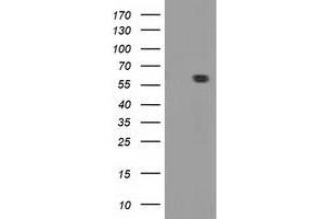 Image no. 2 for anti-Dystrobrevin alpha (DTNA) antibody (ABIN2719777)