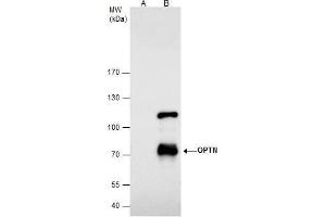 Image no. 2 for anti-Optineurin (OPTN) (Center) antibody (ABIN2856108)