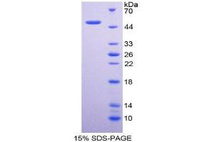 Image no. 1 for delta-Like 1 Homolog (Drosophila) (DLK1) (AA 24-175) protein (His tag,GST tag) (ABIN1981230)
