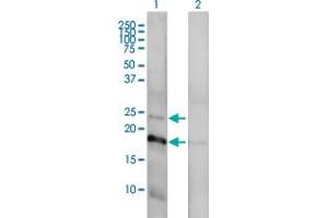 Image no. 2 for anti-Claudin 1 (CLDN1) (AA 1-211) antibody (ABIN563931)
