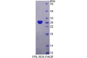 Image no. 1 for Synaptosomal-Associated Protein, 25kDa (SNAP25) (AA 1-206) protein (T7 tag,His tag) (ABIN6238183)