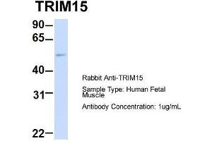 Image no. 3 for anti-Tripartite Motif Containing 15 (TRIM15) (Middle Region) antibody (ABIN2787564)