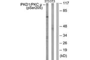 Western blot analysis of extracts from NIH-3T3 cells treated with Anisomycin 25ug/ml 30', using PKD1/PKC mu (Phospho-Ser205) Antibody.