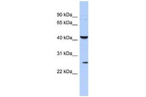 Image no. 1 for anti-Potassium Large Conductance Calcium-Activated Channel, Subfamily M, beta Member 4 (KCNMB4) (Middle Region) antibody (ABIN633681)