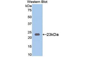 Image no. 1 for anti-Keratin 23 (KRT23) (AA 243-382) antibody (ABIN1171784)