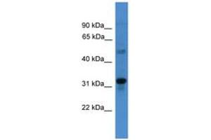 Image no. 1 for anti-Transmembrane Protein 176B (TMEM176B) (C-Term) antibody (ABIN6745490)