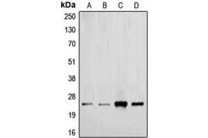 Image no. 2 for anti-Transforming Growth Factor, beta 2 (TGFB2) (C-Term) antibody (ABIN2705289)