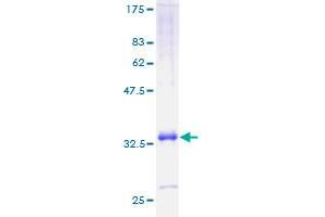 Image no. 1 for Chemokine (C-X-C Motif) Ligand 11 (CXCL11) (AA 1-94) protein (GST tag) (ABIN1350810)