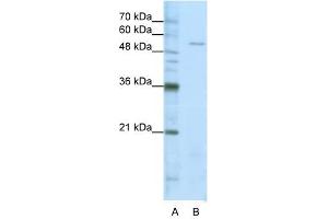 Image no. 1 for anti-Seryl-tRNA Synthetase (SARS) (Middle Region) antibody (ABIN630018)
