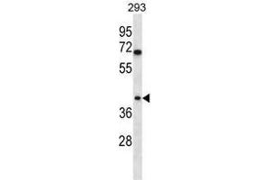 Image no. 2 for anti-Torsin Family 1, Member B (Torsin B) (TOR1B) (AA 214-243), (C-Term) antibody (ABIN955295)
