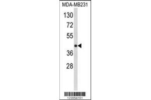 Image no. 1 for anti-HLA Class I Histocompatibility Antigen, alpha Chain E (HLA-E) (AA 108-135) antibody (ABIN652456)