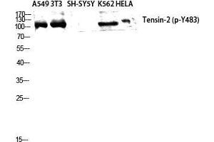 Image no. 2 for anti-Tensin Like C1 Domain Containing Phosphatase (Tensin 2) (TENC1) (pTyr483) antibody (ABIN3182167)