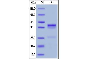 Image no. 1 for Connective Tissue Growth Factor (CTGF) (AA 26-348) protein (His tag) (ABIN6388278)