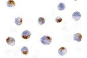 Immunohistochemistry (IHC) image for anti-Apoptotic Chromatin Condensation Inducer 1 (ACIN1) (Middle Region) antibody (ABIN1030843)