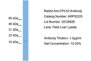 Image no. 2 for anti-Complexin 2 (CPLX2) (N-Term) antibody (ABIN2784835)