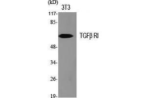 Image no. 2 for anti-Transforming Growth Factor, beta Receptor 1 (TGFBR1) (Tyr159) antibody (ABIN3180915)