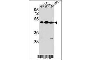 Image no. 1 for anti-Kringle Containing Transmembrane Protein 2 (KREMEN2) (AA 247-276), (Center) antibody (ABIN2488973)