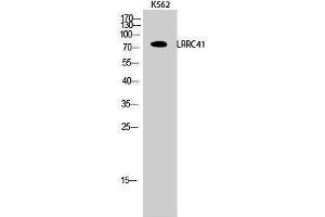 Image no. 1 for anti-Leucine Rich Repeat Containing 41 (LRRC41) (Internal Region) antibody (ABIN3185414)