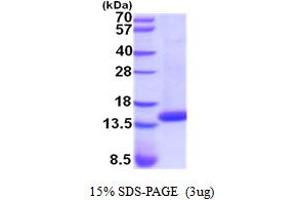 Image no. 1 for Cystatin D (CST5) (AA 26-142) (Active) protein (His tag) (ABIN5854281)
