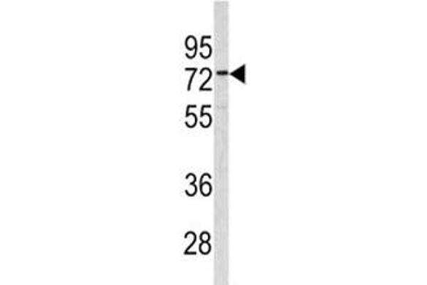 CEA antibody  (AA 400-429)