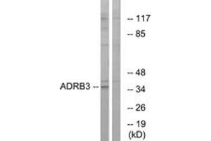 Image no. 1 for anti-Adrenergic, beta-3-, Receptor (ADRB3) (AA 250-299) antibody (ABIN1535567)