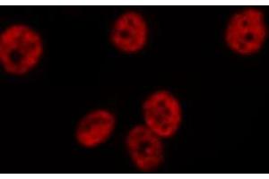 Image no. 3 for anti-Elongation Factor Tu GTP Binding Domain Containing 2 (EFTUD2) antibody (ABIN6258507)