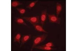 Image no. 3 for anti-Protein Phosphatase 2, Regulatory Subunit A, alpha (PPP2R1A) (C-Term) antibody (ABIN354403)