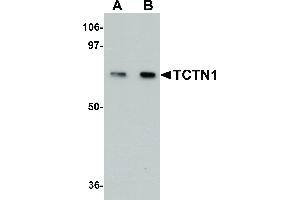 Image no. 1 for anti-Tectonic Family Member 1 (TCTN1) (N-Term) antibody (ABIN6655922)