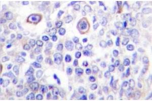 Image no. 2 for anti-CD83 (CD83) antibody (ABIN272283)