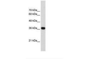 Image no. 1 for anti-PC4 and SFRS1 Interacting Protein 1 (PSIP1) (AA 85-134) antibody (ABIN203293)