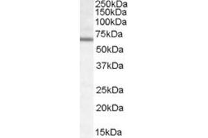 Image no. 1 for anti-Dachshund 2 (DACH2) (Internal Region) antibody (ABIN334383)