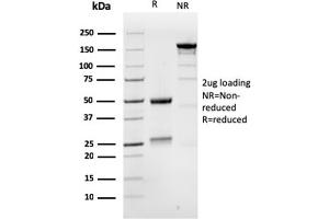 Image no. 6 for anti-MutS Homolog 6 (E. Coli) (MSH6) (AA 374-540) antibody (ABIN6939580)