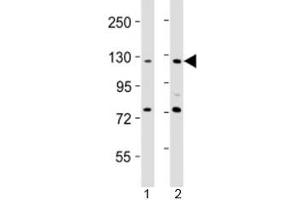 Image no. 1 for anti-Apoptosis-Associated tyrosine Kinase (AATK) (AA 55-90) antibody (ABIN5647807)