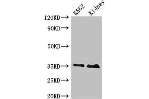 TRADD Antikörper  (AA 1-312)