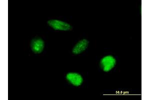 Image no. 2 for anti-AF4/FMR2 Family, Member 4 (AFF4) (AA 1-365) antibody (ABIN525853)