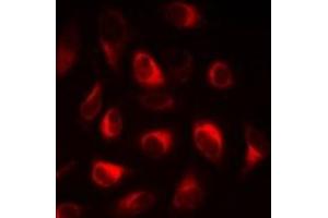 Image no. 1 for anti-Fatty Acid Binding Protein 5 (Psoriasis-Associated) (FABP5) antibody (ABIN3198059)