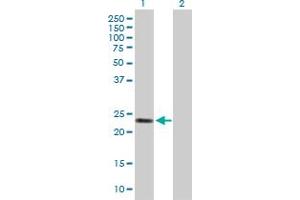 Image no. 1 for anti-Glutathione S-Transferase alpha 2 (GSTa2) (AA 1-222) antibody (ABIN516221)