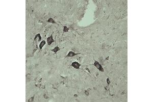 Image no. 2 for anti-Vacuolar Protein Sorting 45 (VPS45) antibody (ABIN351329)