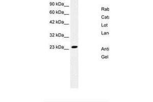 Image no. 2 for anti-MYST/Esa1-Associated Factor 6 (MEAF6) (N-Term) antibody (ABIN6736265)