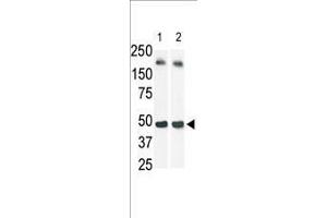 Image no. 1 for anti-Sphingosine Kinase 1 (SPHK1) (AA 1-30), (N-Term) antibody (ABIN391345)