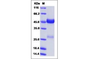 Image no. 1 for Nephroblastoma Overexpressed (NOV) (AA 1-357) protein (His tag) (ABIN2009807)