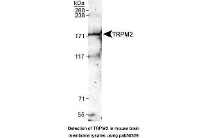 Image no. 1 for anti-Transient Receptor Potential Cation Channel, Subfamily M, Member 2 (TRPM2) (AA 1200-1300) antibody (ABIN363638)