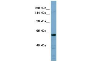 Image no. 1 for anti-Cadherin 23 (CDH23) (Middle Region) antibody (ABIN2783852)