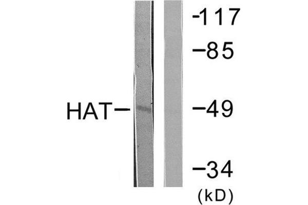 anti-Histone Acetyltransferase (HAT) (C-Term) antibody
