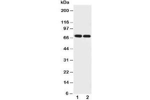 Western blot testing of Netrin 1 antibody and Lane 1:  U87;  2: COLO320 cell lysate.