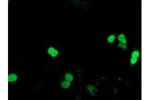 Image no. 2 for anti-Synovial Sarcoma, X Breakpoint 1 (SSX1) antibody (ABIN1501157)