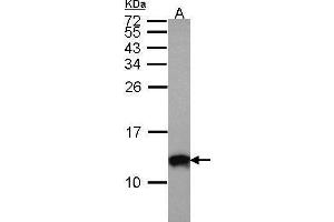 WB Image Sample (30 ug of whole cell lysate) A: A431 , 15% SDS PAGE antibody diluted at 1:1000