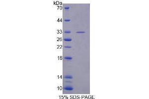 Image no. 1 for Exportin 4 (XPO4) (AA 881-1151) protein (His tag) (ABIN6239680)